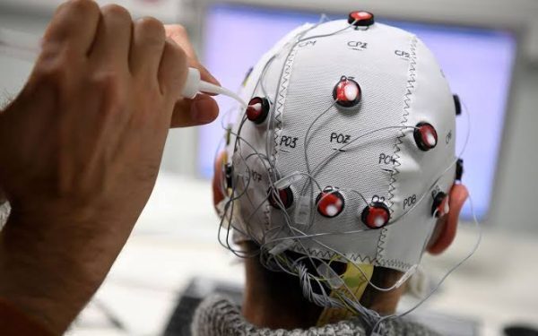 China implants 1st commercial BCI with Neuracle device in patient